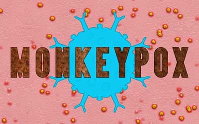Monkeypox